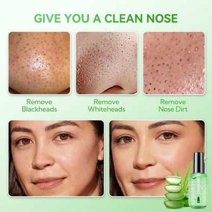 🌿 50% OFF Green Tea Blackhead Remover Kit ✨ 100 Pore Strips + Pore Care Serum