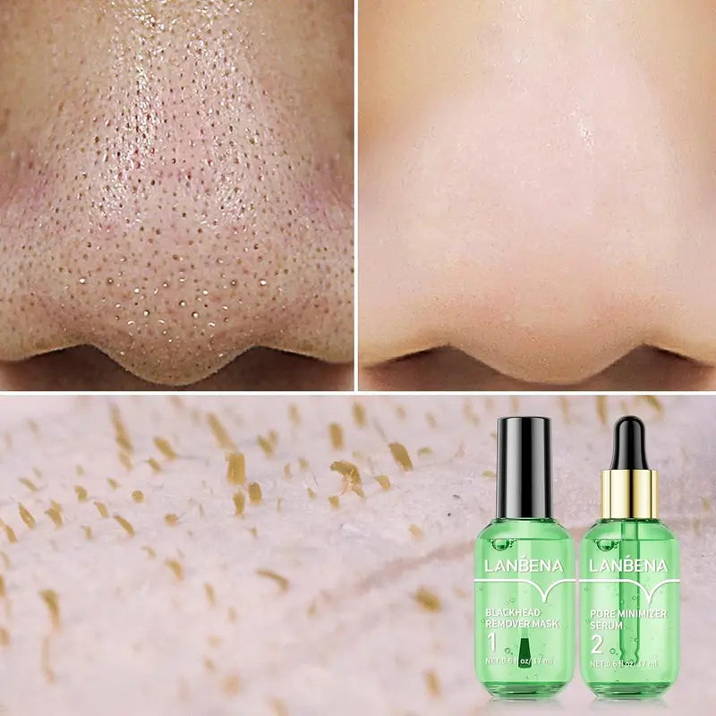 🌿 50% OFF Green Tea Blackhead Remover Kit ✨ 100 Pore Strips + Pore Care Serum