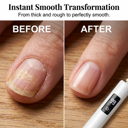 Professional Ultra-Safe LED Electric Nail Grinder